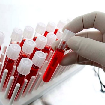 Что показывает анализ АФП при беременности? Анализ афп при беременности