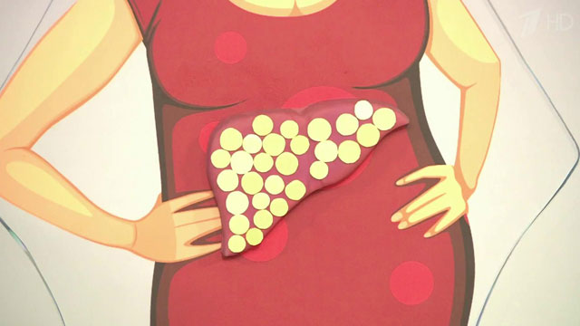 Болит печень при беременности: стоит ли беспокоиться? Болит печень при беременности