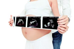 Распечатанный результат УЗИ на 20 неделе беременности станет первым фото ребенка