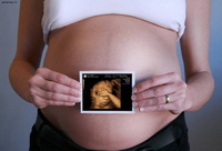 3-D УЗИ при беременности. Его цена и основные преимущества Узи 3д при беременности фото