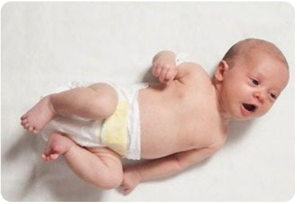 Кривошея у новорожденных: как распознать? Как лечить? Кривошея у новорожденных - патология, требующая обязательного лечения