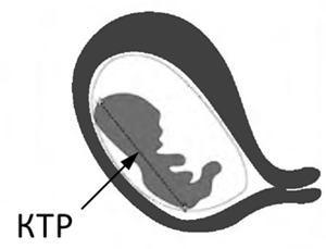 КТР плода: что это такое? КТР плода - это копчико-теменной размер эмбриона