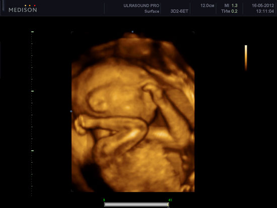 УЗИ на 27 неделе беременности: показания и показатели УЗИ на 27 неделе беременности не входит в плановые процедуры