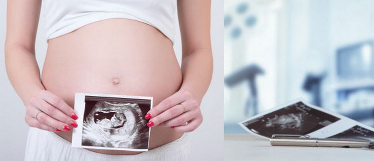 УЗИ на 39 неделе беременности: третий плановый скрининг Узи на 39 неделе беременности - последнее плановое исследование