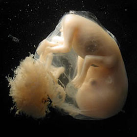 УЗИ в 9 недель беременности также позволит выявить отклонения на ранеей стадии развития плода
