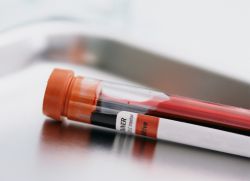 Фибриноген при беременности: каким должен быть его уровень и на что он влияет? Фибриноген при беременности необходимо контролировать