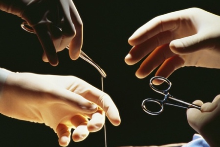 Швы после родов: что с ними делать? Швы после родов бывают внешними и внутренними