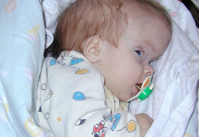 Самые опасные патологии: гидроцефалия у детей Гидроцефалия головного мозга у детей - одна из самых опасных патологий