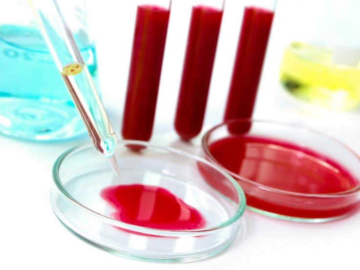 Назначение биохимического анализа крови