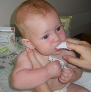 Как убрать белый налет с языка малыша фото