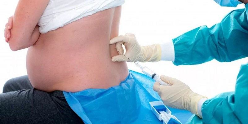 Болит спина после эпидуральной анестезии: нормально ли это и что делать?