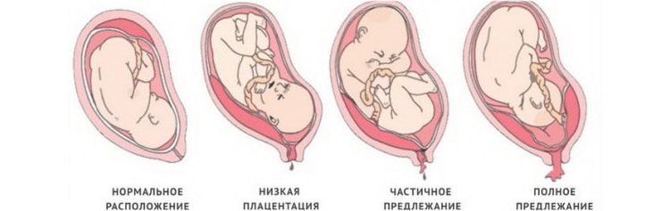 читайте в нашей статье о том когда формируется плацента при беременности и каковы её основные функции