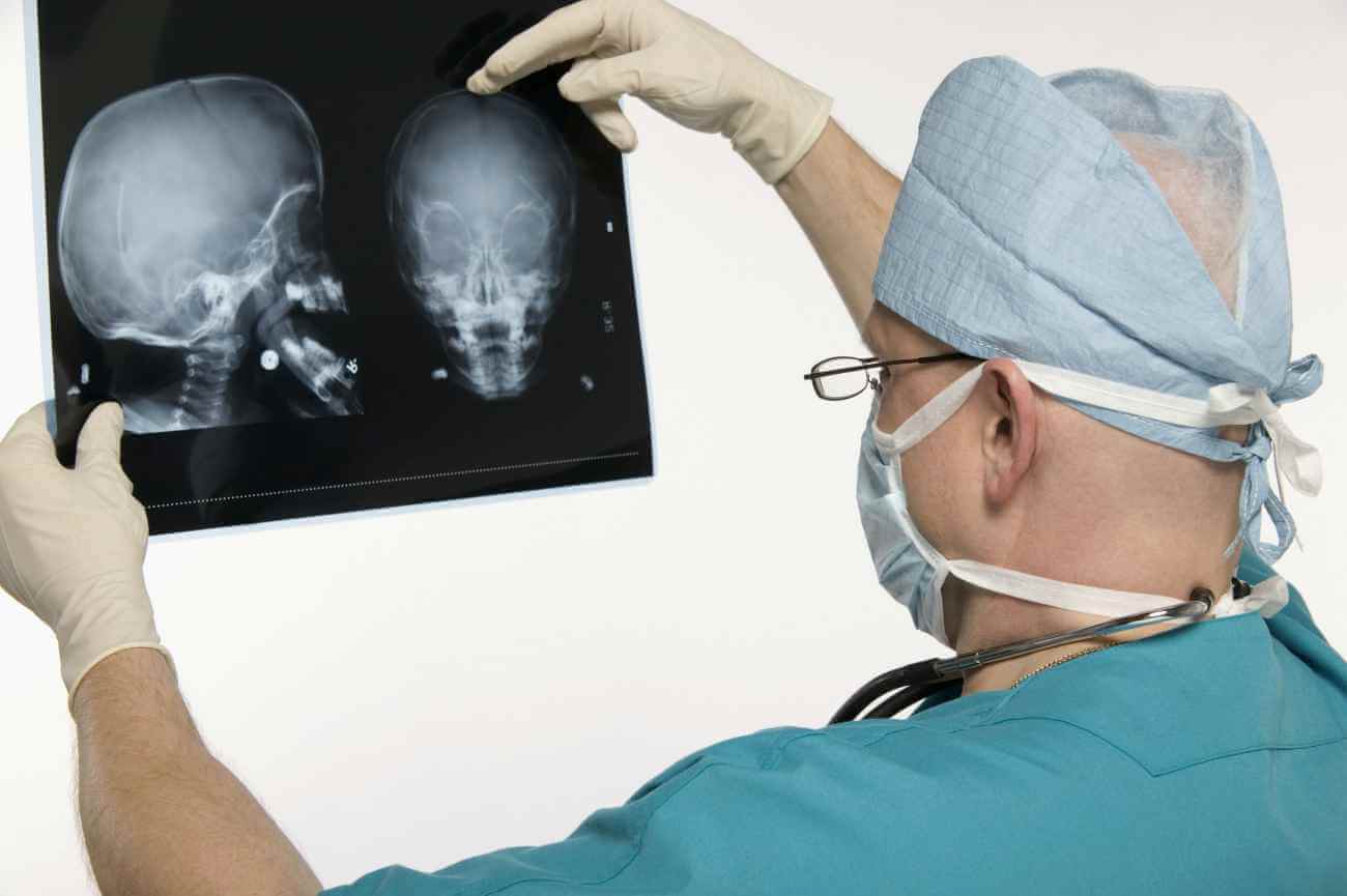 Врач затылок. Рентгенологическое исследование черепа. Рентгенография головы.