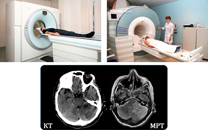 КТ и МРТ головного мозга