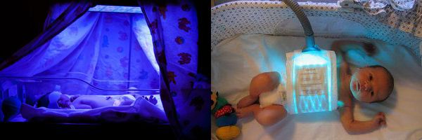 Фототерапия новорожденного