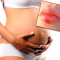 Герпес на губе при беременности 1 триместр