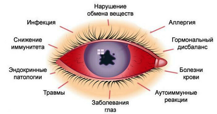 Причины воспаления глаз