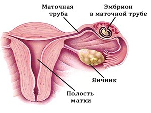 Развитие внутриматочной беременности