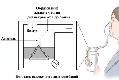 Процесс работы небулайзера