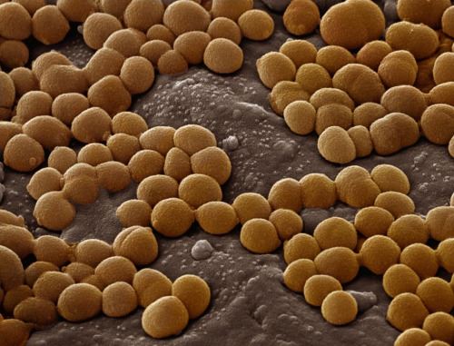 В патогенной микрофлоре нередко присутствуют кокки