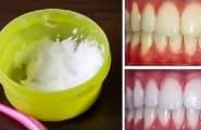Обеливание зубов в домашних условиях