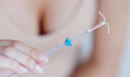 Когда можно ставить спираль после родов, разрешено ли ее носить при грудном вскармливании?