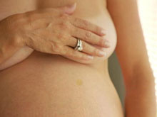растяжки на груди во время беременности