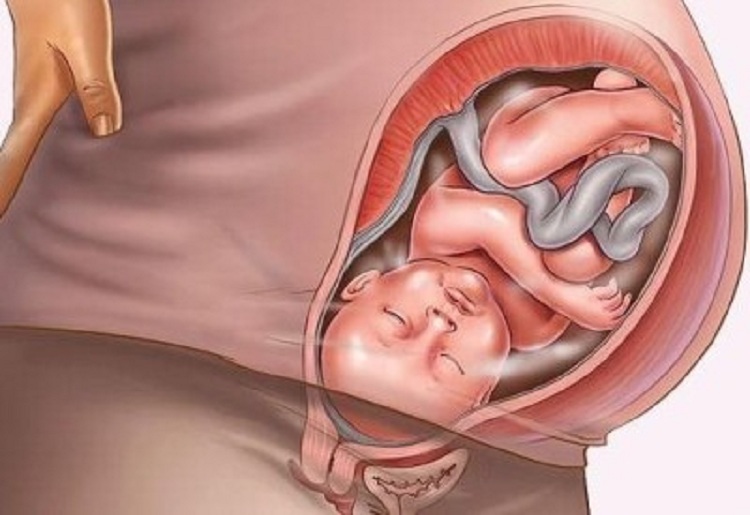 Крипторхизм у мальчиков: в каком возрасте опускаются яички у детей и когда нужно лечение, операция?