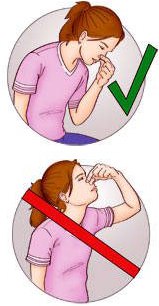 как остановить сильное кровотечение из носа