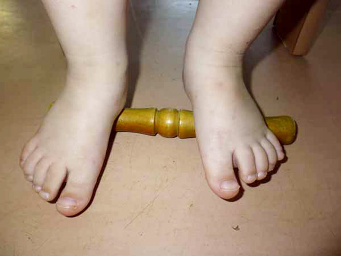 Ребенок выполняет массаж ступней при помощи палки