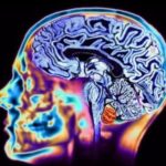 Показания и противопоказания к МРТ головного мозга – магнитно-резонансная томография головы