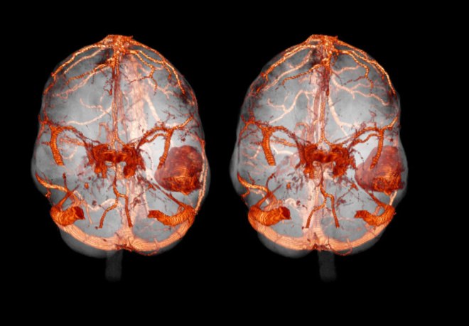Снимки КТ головного мозга с контрастом