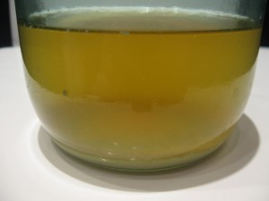 Белые хлопья в моче у мужчин