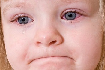 Красная припухлость под глазами у ребенка - о чем говорит этот симптом
