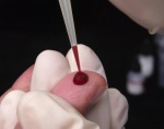 Нормы при биохимическом анализе крови: как расшифровать результат