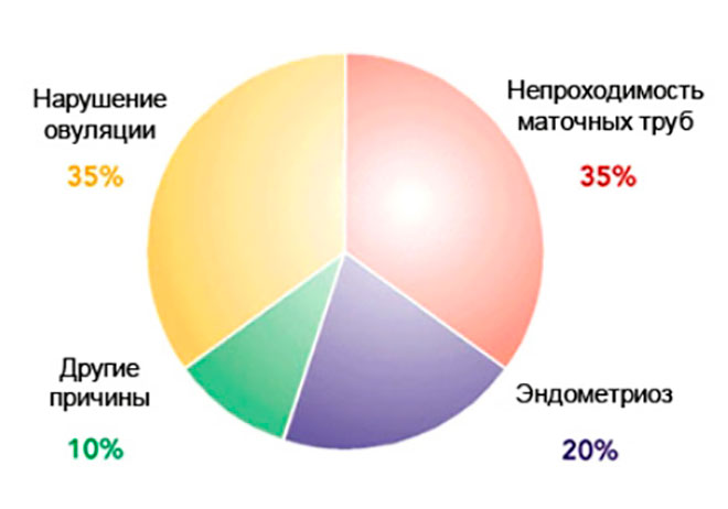 инфографика факторов бесплодия