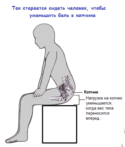 После родов болит копчик и поясница: почему больно сидеть и что делать?