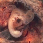 эмбрион