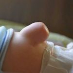 Пупочная грыжа у новорожденных массаж видео комаровский