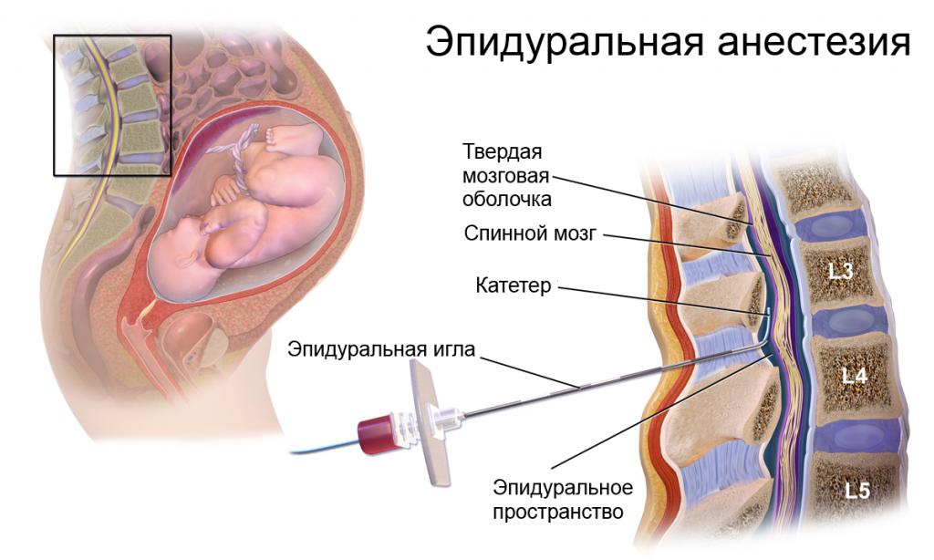 Что такое роды, каковы этапы процесса родовой деятельности, какие ощущения присутствуют у женщины?