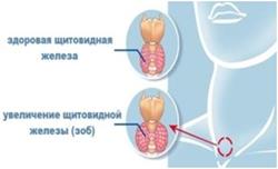 Норма щитовидки
