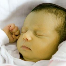 Желтуха у новорождённых: почему ребенок желтеет после родов