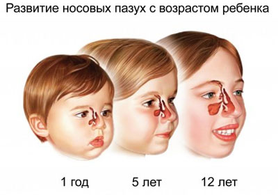 Развитие носовых пазух у детей