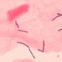 Микрофлора женских половых органов