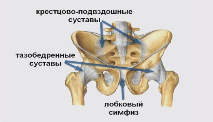 Лобковый симфизит