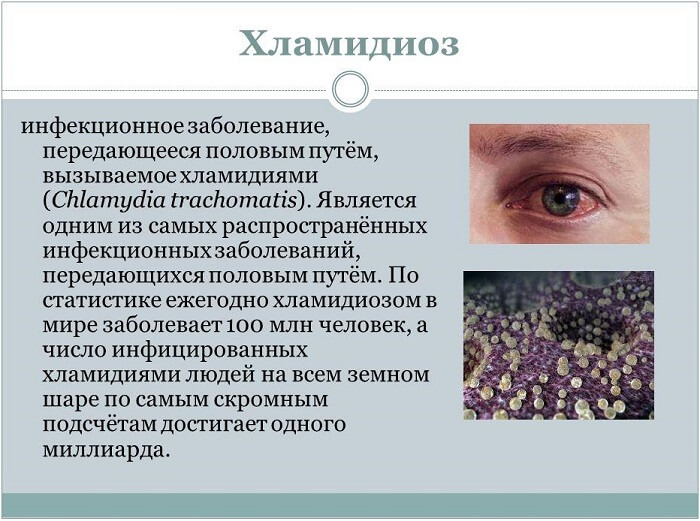 Хламидиоз глаза человека