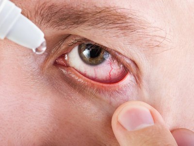 От чего помогает глазные капли Тобрекс: инструкция для детей