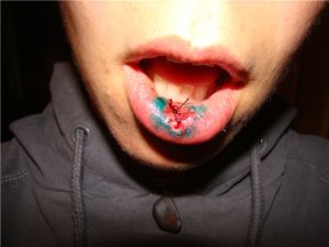 травма губы после операции