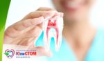 Лечение молочных зубов: cовременный подход