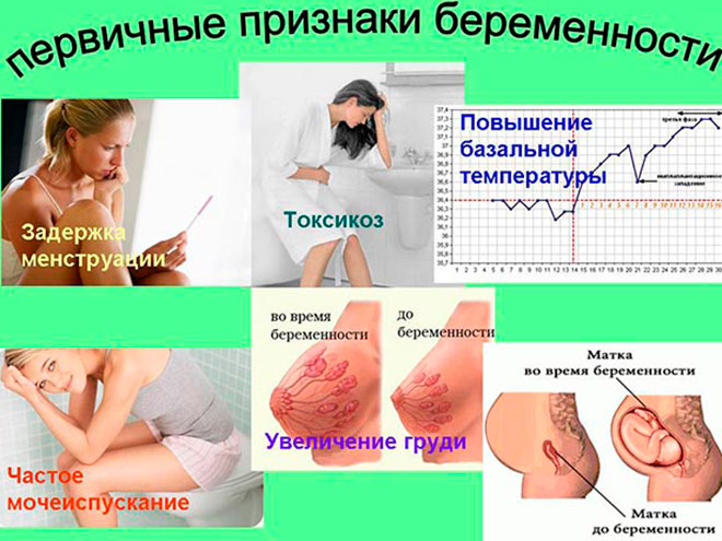 симптомы беременности